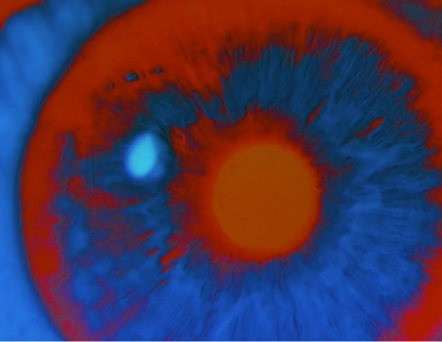 eye